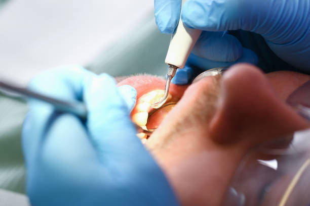 Best Emergency Dental Services for Seniors in Tellico Village, TN