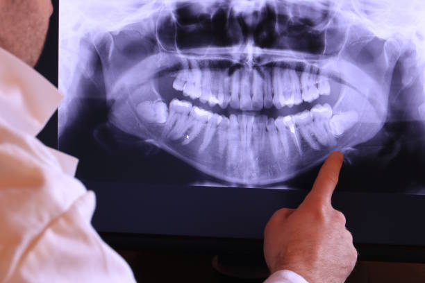 Best Mobile Emergency Dentist in Tellico Village, TN